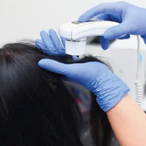 Hair Fall Treatment