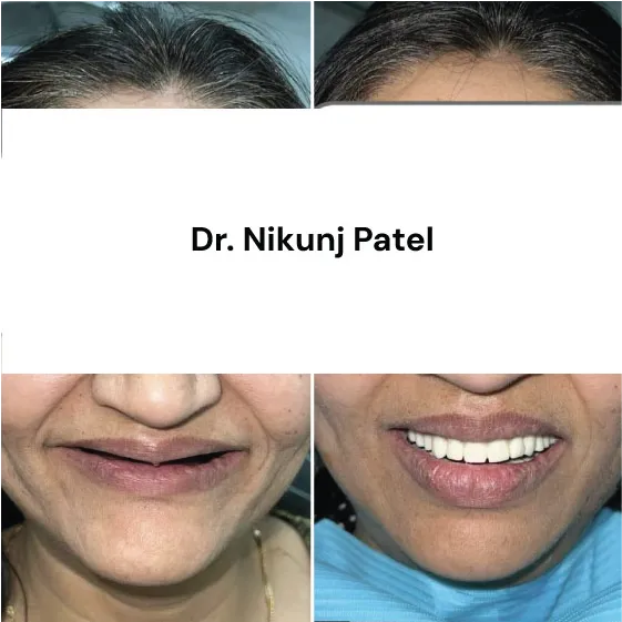 dr nikunj patel