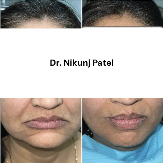 dr nikunj patel patient