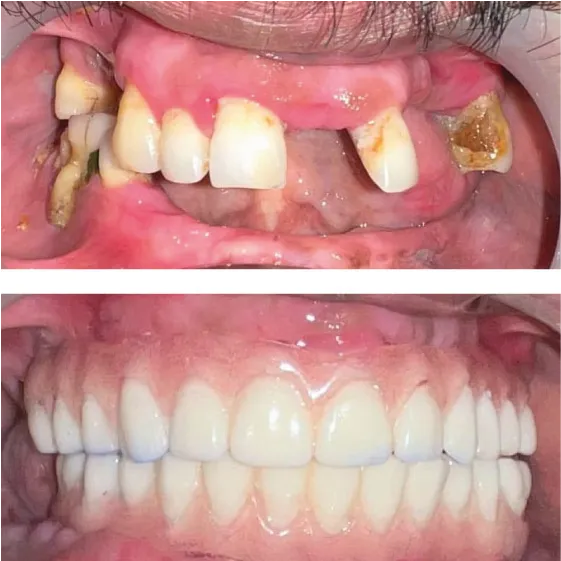 teeth